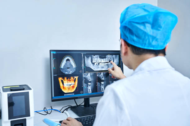 Best Emergency Dentist for Lost Fillings or Crowns in Felton, CA