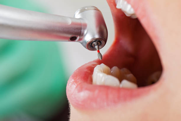 Best Holiday Emergency Dentist in Felton, CA